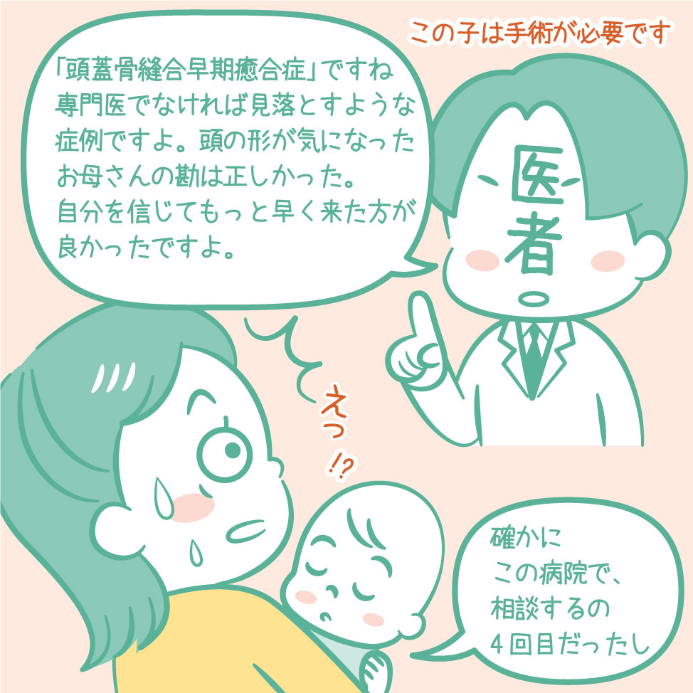 頭の歪みが 頭蓋骨縫合早期癒合症 と診断された双子ママの経験談 赤ちゃんの頭のかたち相談室